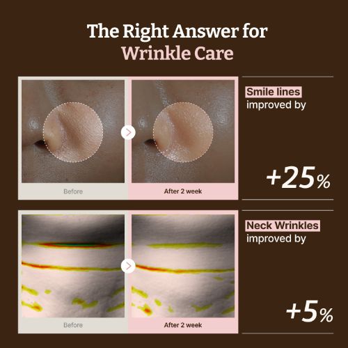 [Dr.Reju-All] Advanced PDRN Rejuvenating Mask (4ea)