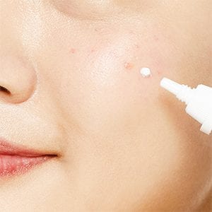 Best Products for Acne!