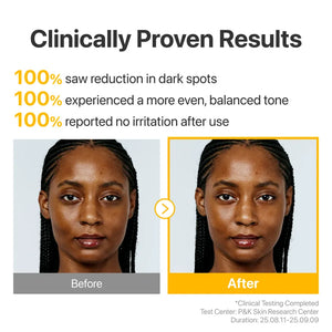 [Numbuzin] No.5 Glutathione TXA Advanced Dark Spot Ampoule Concentrate 10g+0.7g