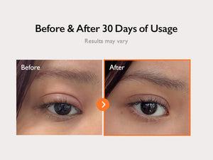[Genabelle] PDRN 360 Rejuvenating Eye Mask (70ea)